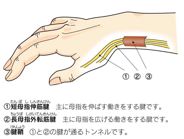 フィンケルシュタイン テストを使用する理由