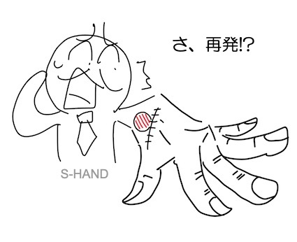 ガングリオンは手術をしても再発する